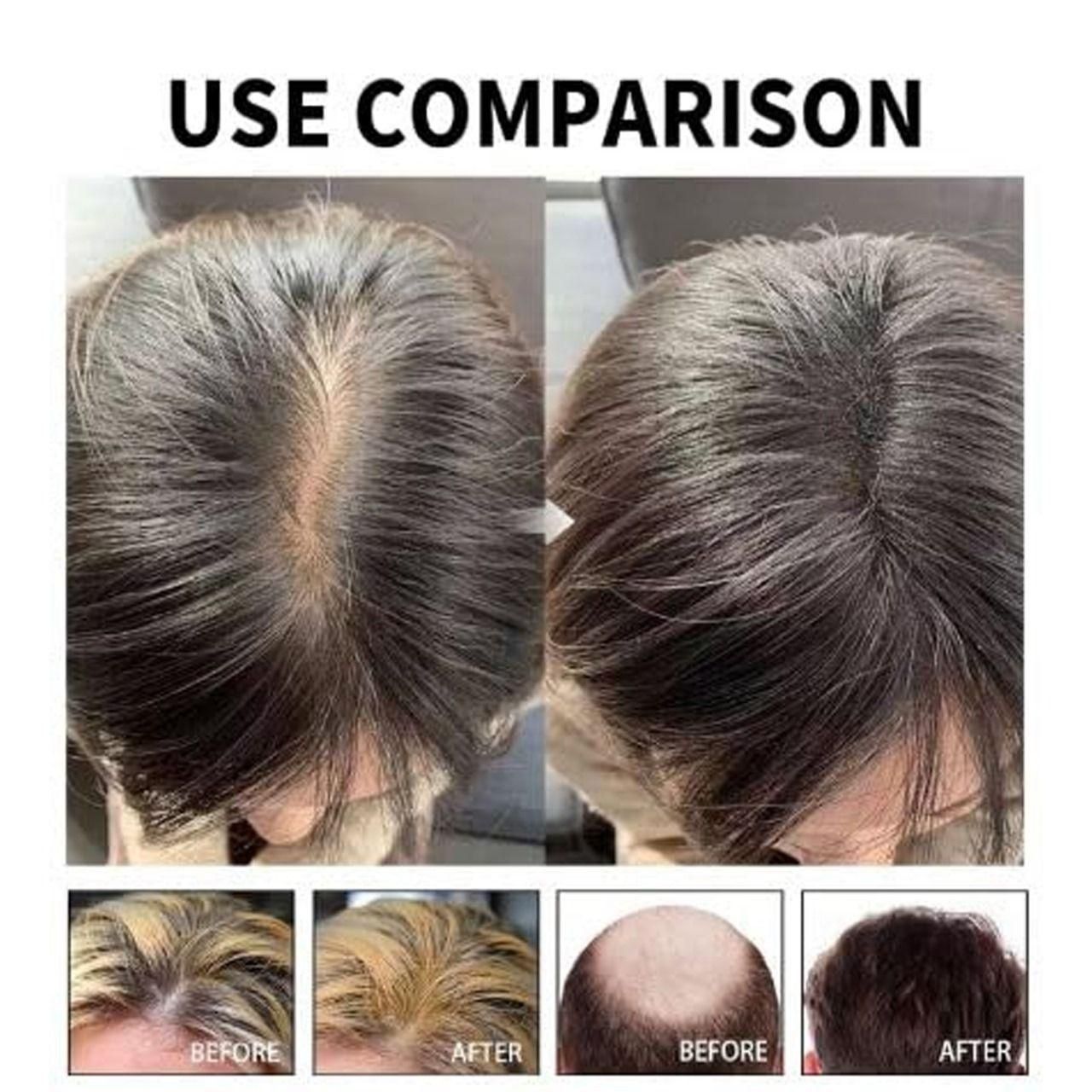 Hair Growth Serum – 30ml Twin Pack | Buy 1 & Get 1 Free