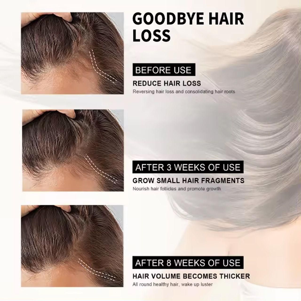 Hair Growth Serum – 30ml Twin Pack | Buy 1 & Get 1 Free