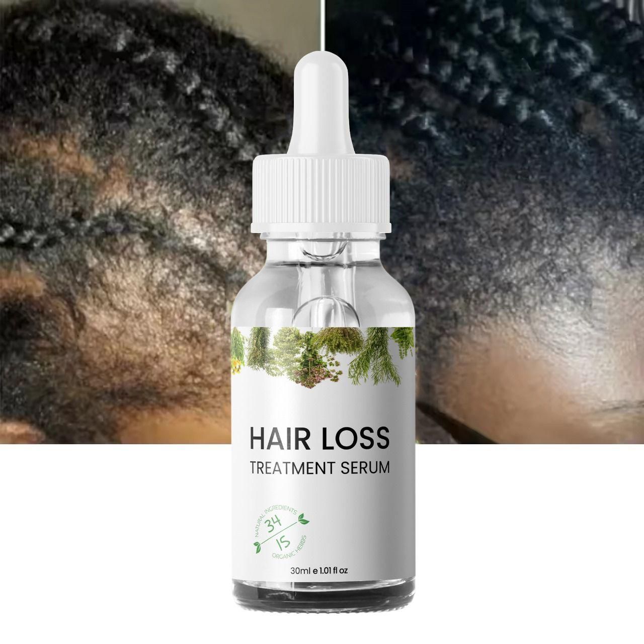 Hair Growth Serum – 30ml Twin Pack | Buy 1 & Get 1 Free