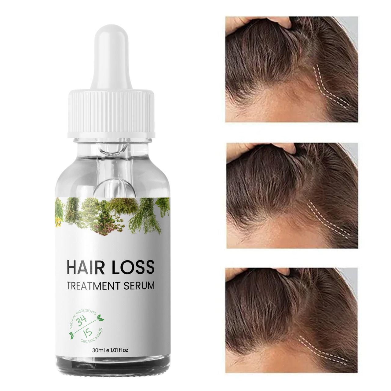 Hair Growth Serum – 30ml Twin Pack | Buy 1 & Get 1 Free