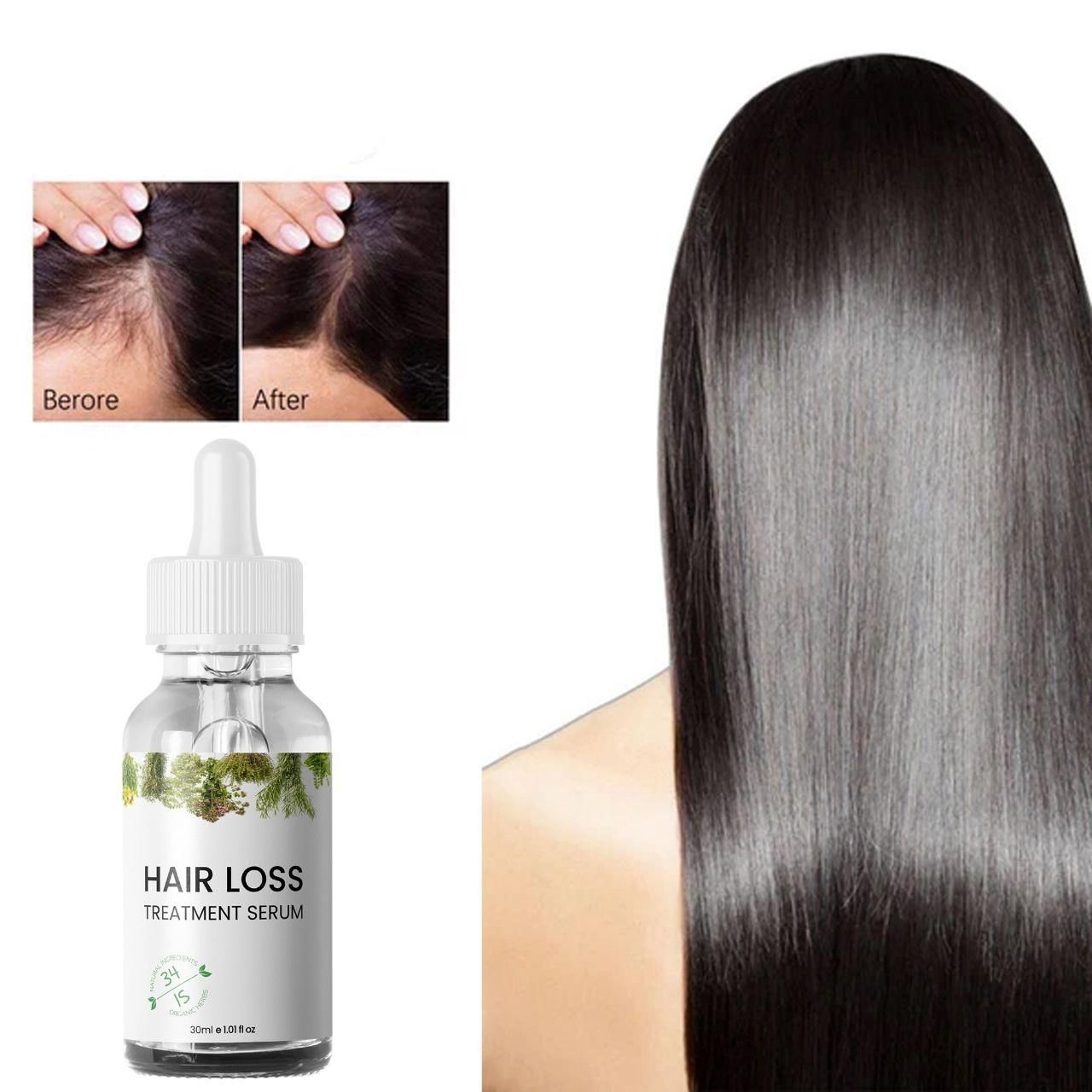 Hair Growth Serum – 30ml Twin Pack | Buy 1 & Get 1 Free
